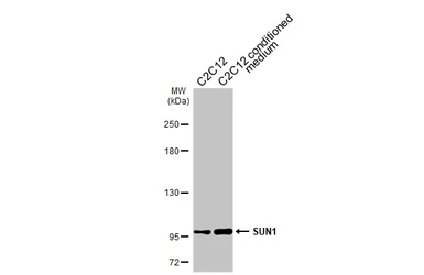 Anti-SUN1 antibody [HL2366] used in Western Blot (WB). GTX638572