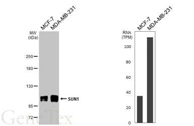 Anti-SUN1 antibody [HL2366] used in Western Blot (WB). GTX638572