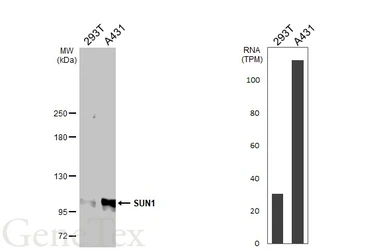 Anti-SUN1 antibody [HL2366] used in Western Blot (WB). GTX638572