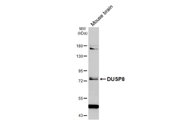 Anti-DUSP8 antibody [HL2374] used in Western Blot (WB). GTX638582