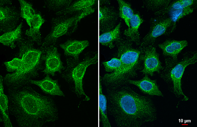 Anti-SNX5 antibody [HL2375] used in Immunocytochemistry/ Immunofluorescence (ICC/IF). GTX638583