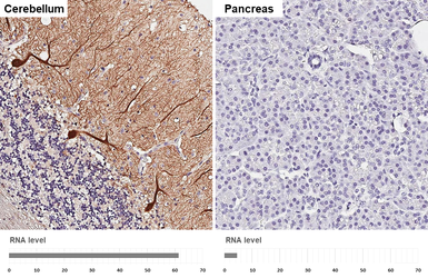 Anti-Calbindin antibody [HL2378] used in IHC (Paraffin sections) (IHC-P). GTX638586