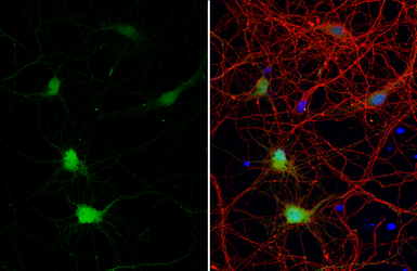 Anti-Calbindin antibody [HL2379] used in Immunocytochemistry/ Immunofluorescence (ICC/IF). GTX638587