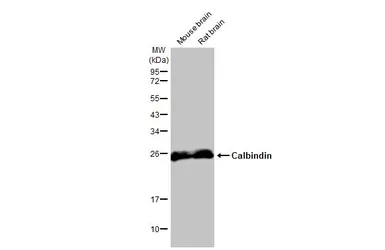 Anti-Calbindin antibody [HL2379] used in Western Blot (WB). GTX638587