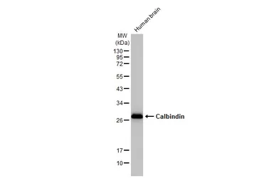 Anti-Calbindin antibody [HL2379] used in Western Blot (WB). GTX638587