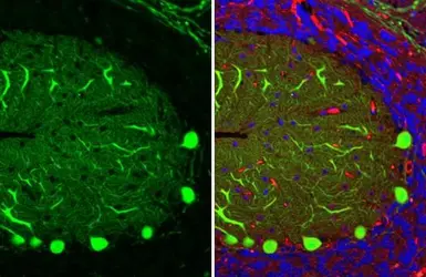 Anti-Calbindin antibody [HL2379] used in IHC (Paraffin sections) (IHC-P). GTX638587