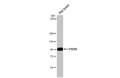 Anti-PSD95 antibody [HL2382] used in Western Blot (WB). GTX638590