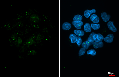 Anti-Coilin antibody [HL2384] used in Immunocytochemistry/ Immunofluorescence (ICC/IF). GTX638593