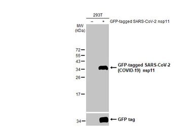 Anti-SARS-CoV-2 (COVID-19) nsp11 antibody [HL2388] used in Western Blot (WB). GTX638597