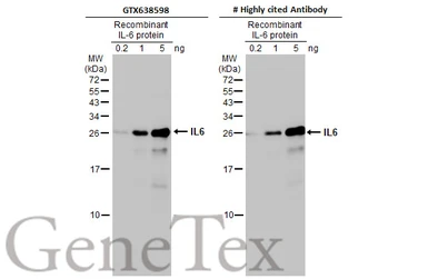 Anti-IL6 antibody [HL2389] used in Western Blot (WB). GTX638598
