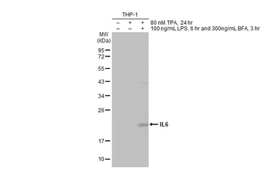 Anti-IL6 antibody [HL2389] used in Western Blot (WB). GTX638598