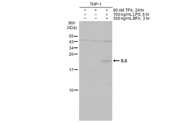 Anti-IL6 antibody [HL2389] used in Western Blot (WB). GTX638598