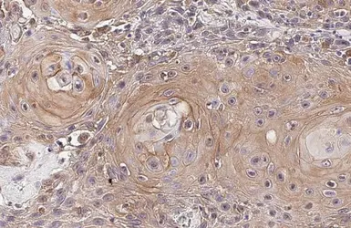 Anti-IL6 antibody [HL2389] used in IHC (Paraffin sections) (IHC-P). GTX638598