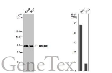 Anti-TBC1D5 antibody [HL2390] used in Western Blot (WB). GTX638599