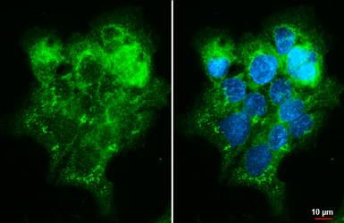 Anti-TBC1D5 antibody [HL2390] used in Immunocytochemistry/ Immunofluorescence (ICC/IF). GTX638599