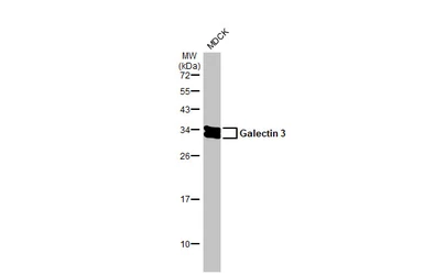 Anti-Galectin 3 antibody [HL2396] used in Western Blot (WB). GTX638613