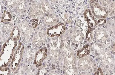 Anti-Galectin 3 antibody [HL2396] used in IHC (Paraffin sections) (IHC-P). GTX638613