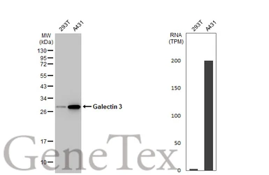 Anti-Galectin 3 antibody [HL2396] used in Western Blot (WB). GTX638613