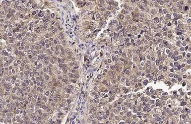 Anti-uPAR antibody [HL2398] used in IHC (Paraffin sections) (IHC-P). GTX638615
