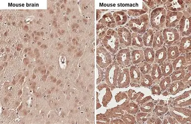 Anti-uPAR antibody [HL2398] used in IHC (Paraffin sections) (IHC-P). GTX638615