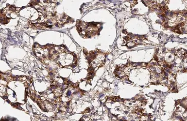 Anti-Collagen I + Collagen II + Collagen III antibody [HL2048 + HL1907] used in IHC (Paraffin sections) (IHC-P). GTX638633