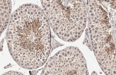 Anti-Collagen I + Collagen II + Collagen III antibody [HL2048 + HL1907] used in IHC (Paraffin sections) (IHC-P). GTX638633