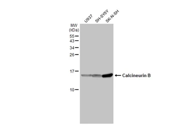 Anti-Calcineurin B antibody [HL2419] used in Western Blot (WB). GTX638641