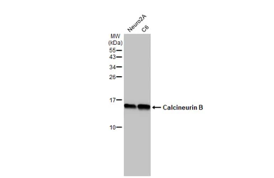 Anti-Calcineurin B antibody [HL2419] used in Western Blot (WB). GTX638641