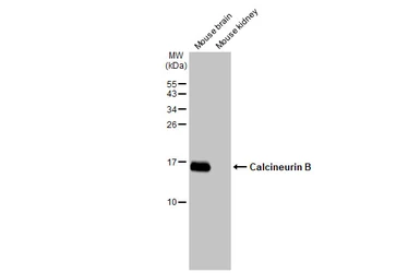 Anti-Calcineurin B antibody [HL2419] used in Western Blot (WB). GTX638641