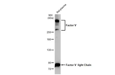 Anti-Factor V antibody [HL2421] used in Western Blot (WB). GTX638643