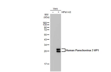 Anti-Human Parechovirus 1+3 VP1 antibody [HL2427] used in Western Blot (WB). GTX638649