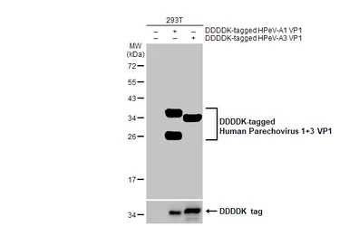 Anti-Human Parechovirus 1+3 VP1 antibody [HL2427] used in Western Blot (WB). GTX638649