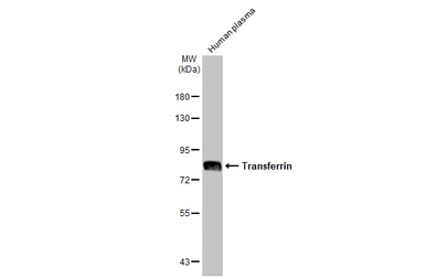 Anti-Transferrin antibody [HL2429] used in Western Blot (WB). GTX638745