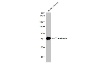 Anti-Transferrin antibody [HL2431] used in Western Blot (WB). GTX638747