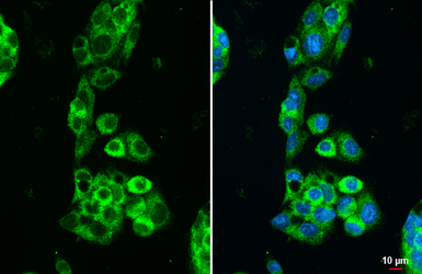 Anti-Transferrin antibody [HL2431] used in Immunocytochemistry/ Immunofluorescence (ICC/IF). GTX638747