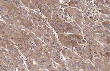 Anti-Transferrin antibody [HL2431] used in IHC (Paraffin sections) (IHC-P). GTX638747