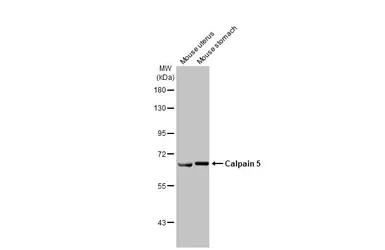 Anti-Calpain 5 antibody [HL2432] used in Western Blot (WB). GTX638748