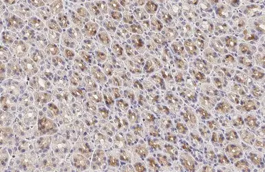 Anti-Calpain 5 antibody [HL2432] used in IHC (Paraffin sections) (IHC-P). GTX638748