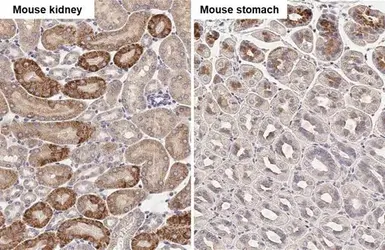 Anti-Calpain 5 antibody [HL2432] used in IHC (Paraffin sections) (IHC-P). GTX638748