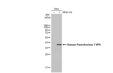 Anti-Human Parechovirus 1+3 VP0 antibody [HL2443] used in Western Blot (WB). GTX638759