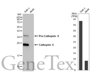 Anti-Cathepsin S antibody [HL2462] used in Western Blot (WB). GTX638780