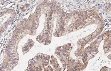 Anti-Cathepsin S antibody [HL2462] used in IHC (Paraffin sections) (IHC-P). GTX638780