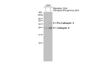 Anti-Cathepsin S antibody [HL2462] used in Western Blot (WB). GTX638780