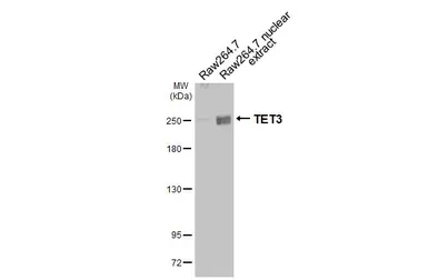 Anti-TET3 antibody [HL2463] used in Western Blot (WB). GTX638781