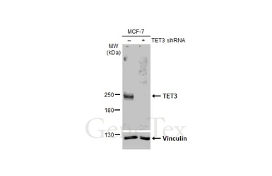 Anti-TET3 antibody [HL2463] used in Western Blot (WB). GTX638781