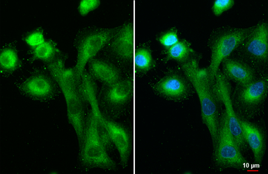 Anti-IFIT3 antibody [HL2468] used in Immunocytochemistry/ Immunofluorescence (ICC/IF). GTX638817