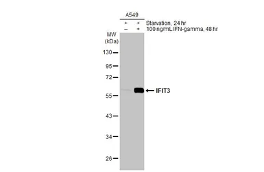 Anti-IFIT3 antibody [HL2469] used in Western Blot (WB). GTX638818
