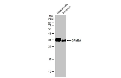 Anti-GPM6A antibody [HL2473] used in Western Blot (WB). GTX638822