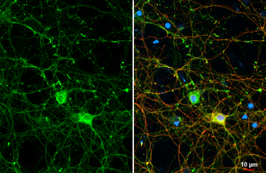 Anti-GPM6A antibody [HL2473] used in Immunocytochemistry/ Immunofluorescence (ICC/IF). GTX638822