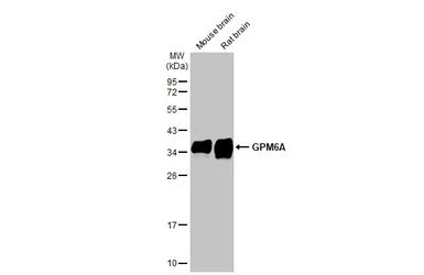 Anti-GPM6A antibody [HL2474] used in Western Blot (WB). GTX638823